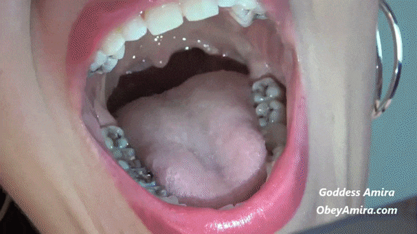 Endoscope uvula