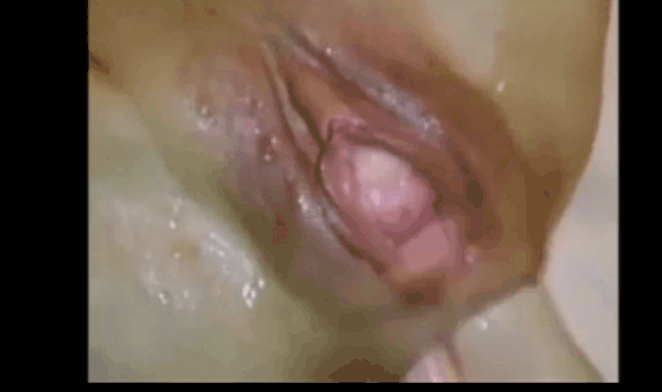 Lightening B. reccomend gape fisting cervix prolapse