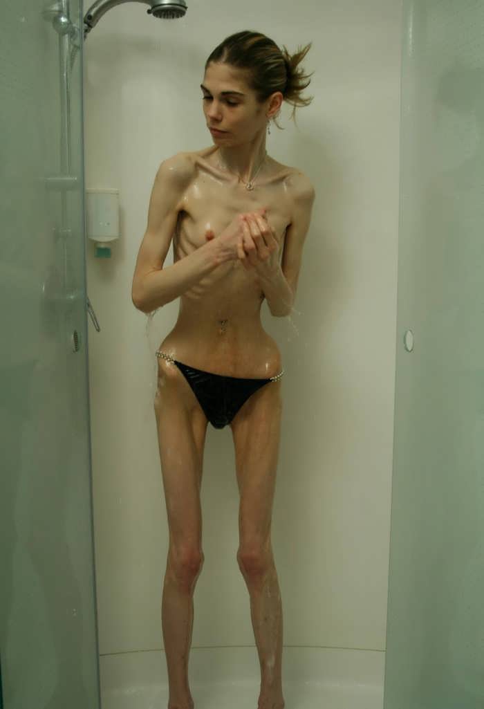 Anorexic Skinny Teen Girls Porn